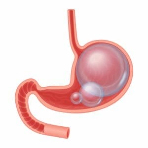 描绘腹胀和肠道的图片 